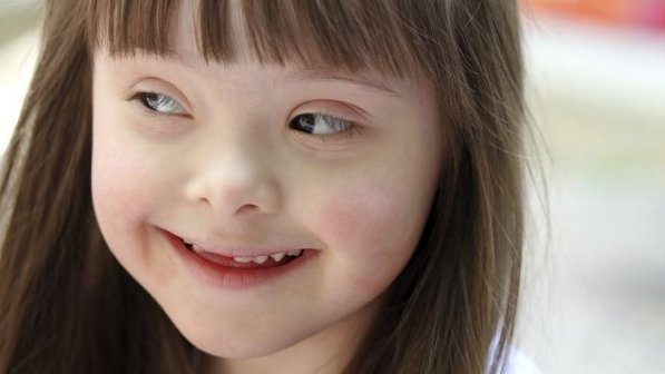 Cientistas-desligam-cromossomo-que-provoca-sindrome-de-Down-01